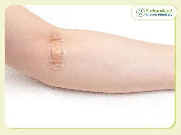 Precautions for blood types testing Precautions for blood types testing