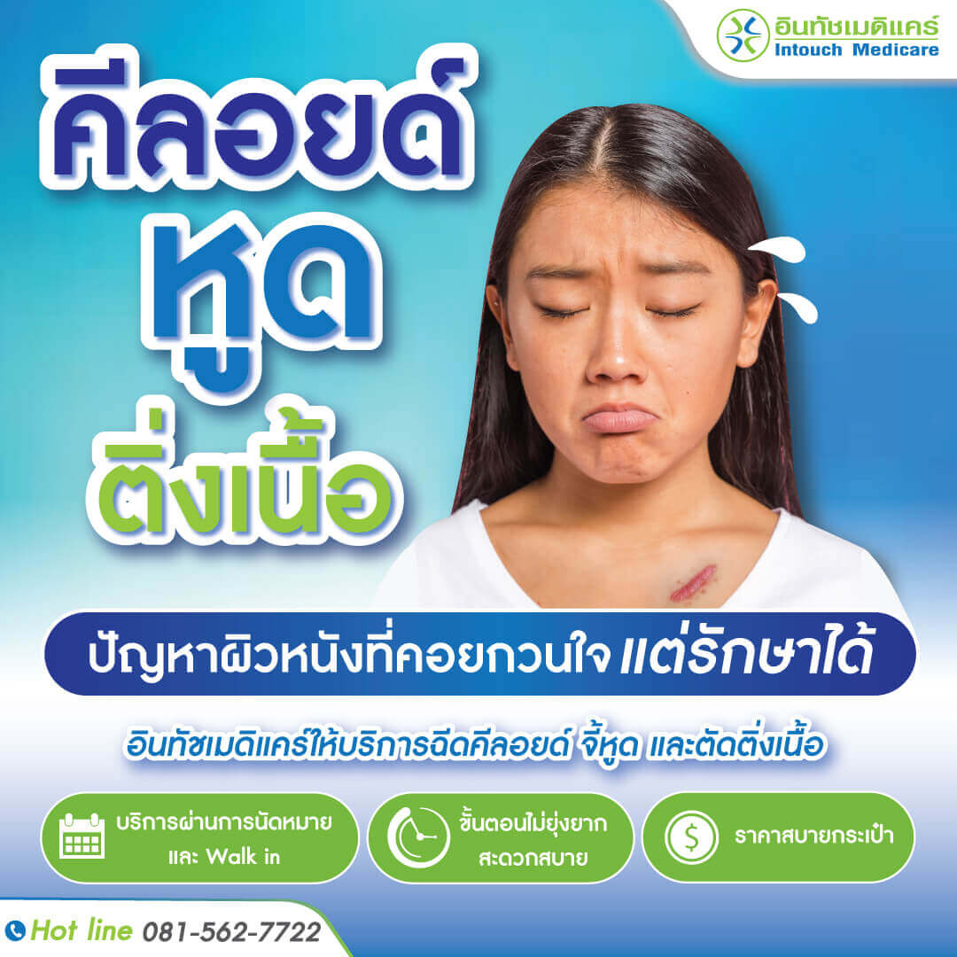 ติดต่อรักษา จี้หูด คีลอยด์ ติดต่อรักษา จี้หูด คีลอยด์