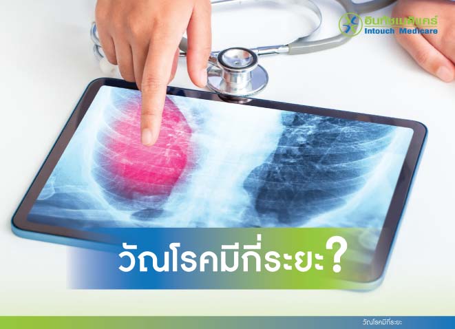 วัณโรคมีกี่ระยะ วัณโรคมีกี่ระยะ
