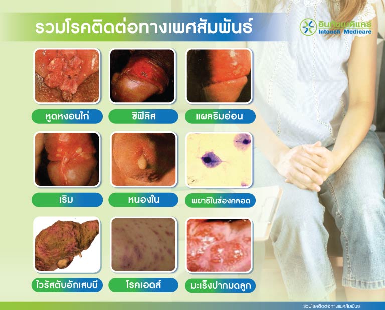 รวมโรคติดต่อทางเพศสัมพันธ์ รวมโรคติดต่อทางเพศสัมพันธ์