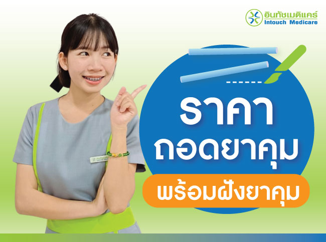 ราคา ถอดยาคุม พร้อมฝังยาคุม