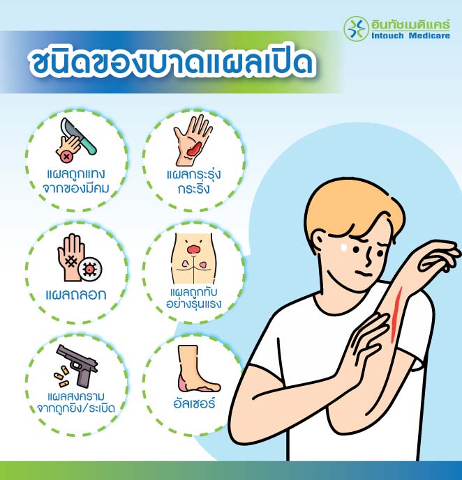 ชนิดของบาดแผลเปิด ชนิดของบาดแผลเปิด