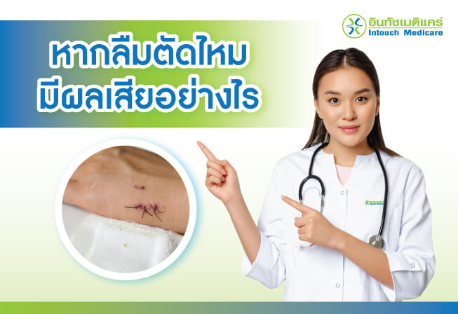 ลืมตัดไหม ลืมตัดไหม