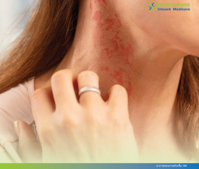 อาการของการติดเชื้อ HIV