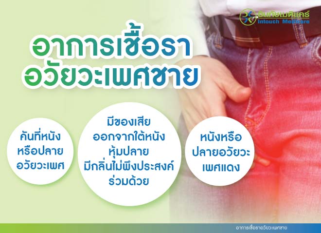 เชื้อราอวัยวะเพศชาย เป็นแล้วรักษาได้ไหม? - intouchmedicare