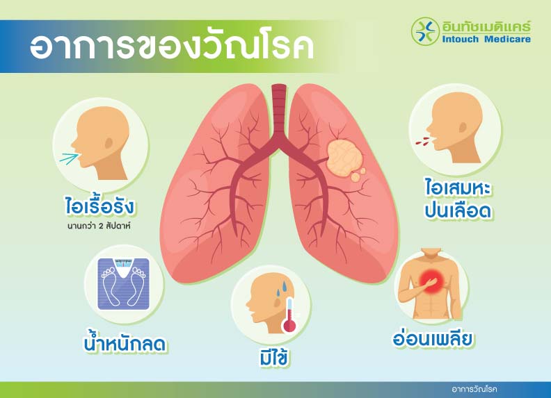 อาการวัณโรค อาการวัณโรค