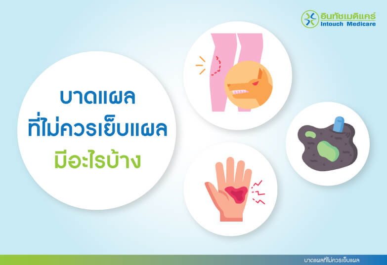 บาดแผลที่ไม่ควรเย็บแผล บาดแผลที่ไม่ควรเย็บแผล