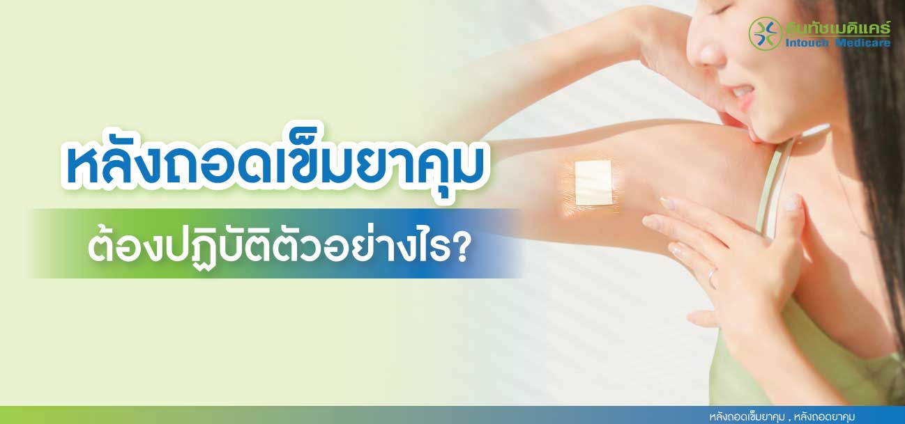 หลังถอดเข็มยาคุม ต้องปฏิบัติตัวอย่างไร หลังถอดเข็มยาคุม ต้องปฏิบัติตัวอย่างไร