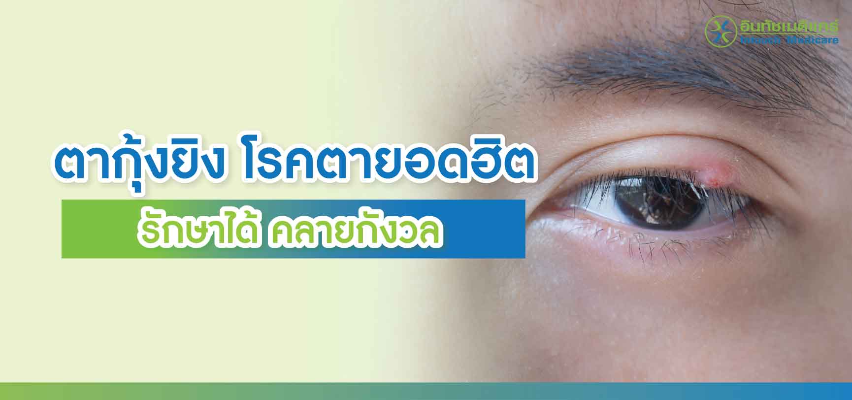 ตากุ้งยิง ตากุ้งยิง