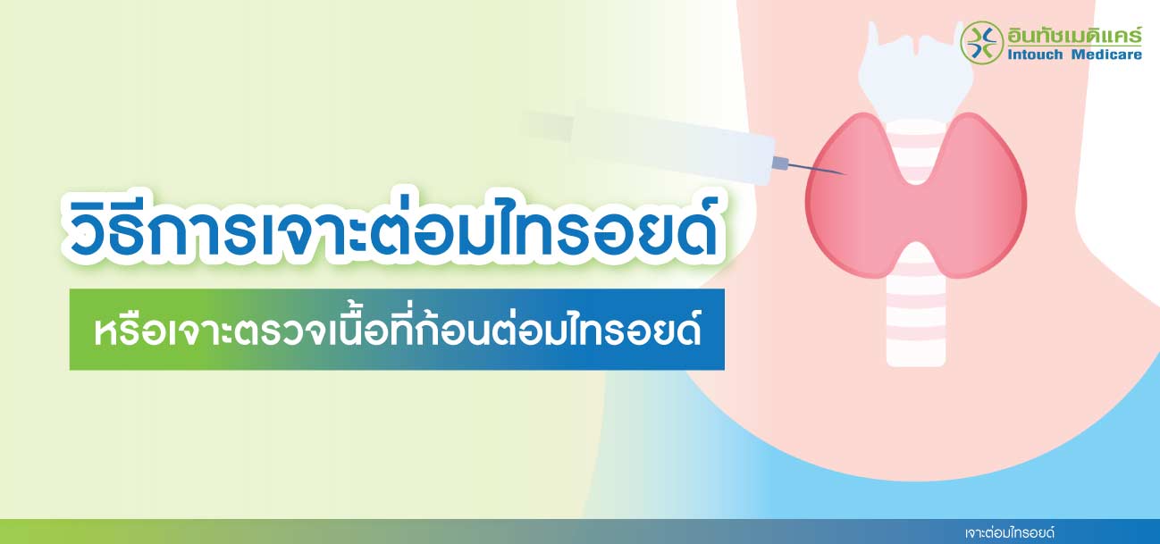 เจาะต่อมไทรอยด์ เจาะต่อมไทรอยด์