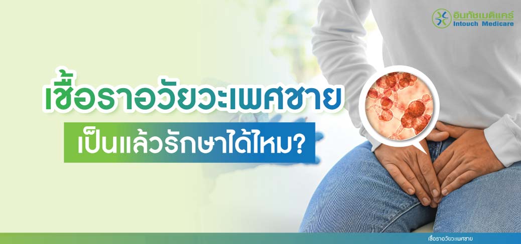 เชื้อราอวัยวะเพศชาย เป็นแล้วรักษาได้ไหม? - intouchmedicare