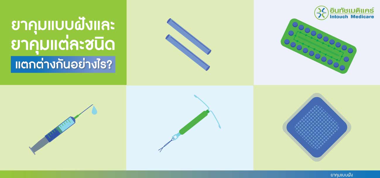 ยาคุมแบบฝัง ยาคุมแบบฝัง