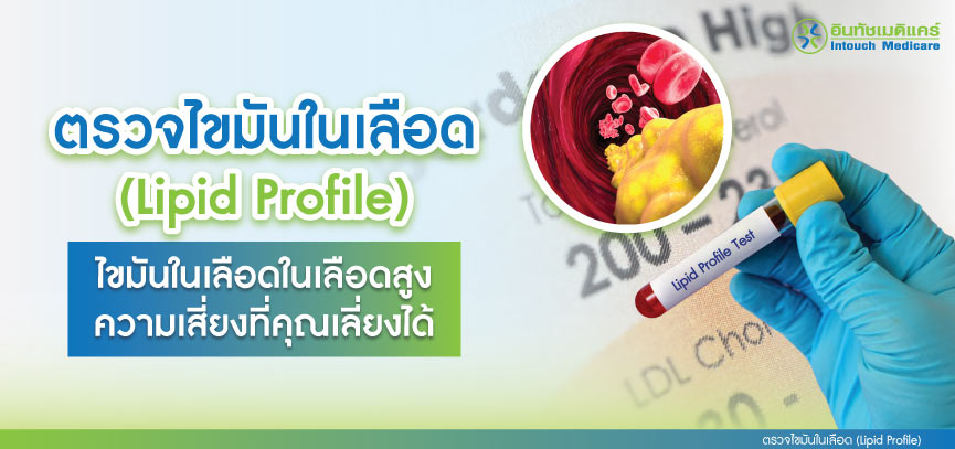 ตรวจไขมันในเลือด (Lipid Profile) ไขมันในเลือดสูง ความเสี่ยงที่คุณเลี่ยงได้ ตรวจไขมันในเลือด (Lipid Profile) ไขมันในเลือดสูง ความเสี่ยงที่คุณเลี่ยงได้