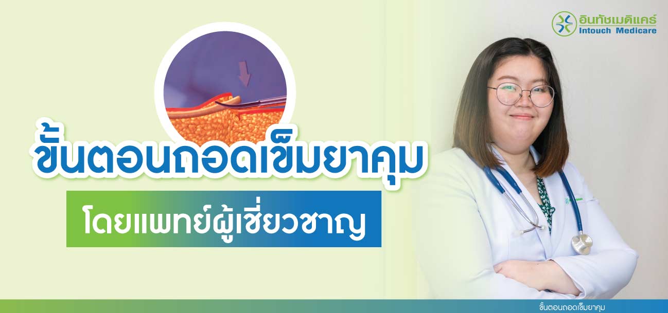 ขั้นตอนถอดเข็มยาคุม ขั้นตอนถอดเข็มยาคุม