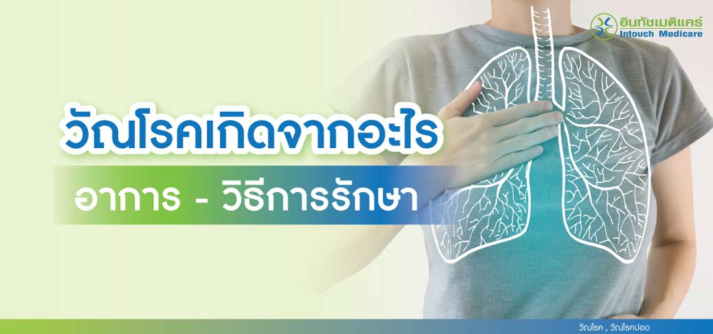 วัณโรค วัณโรค