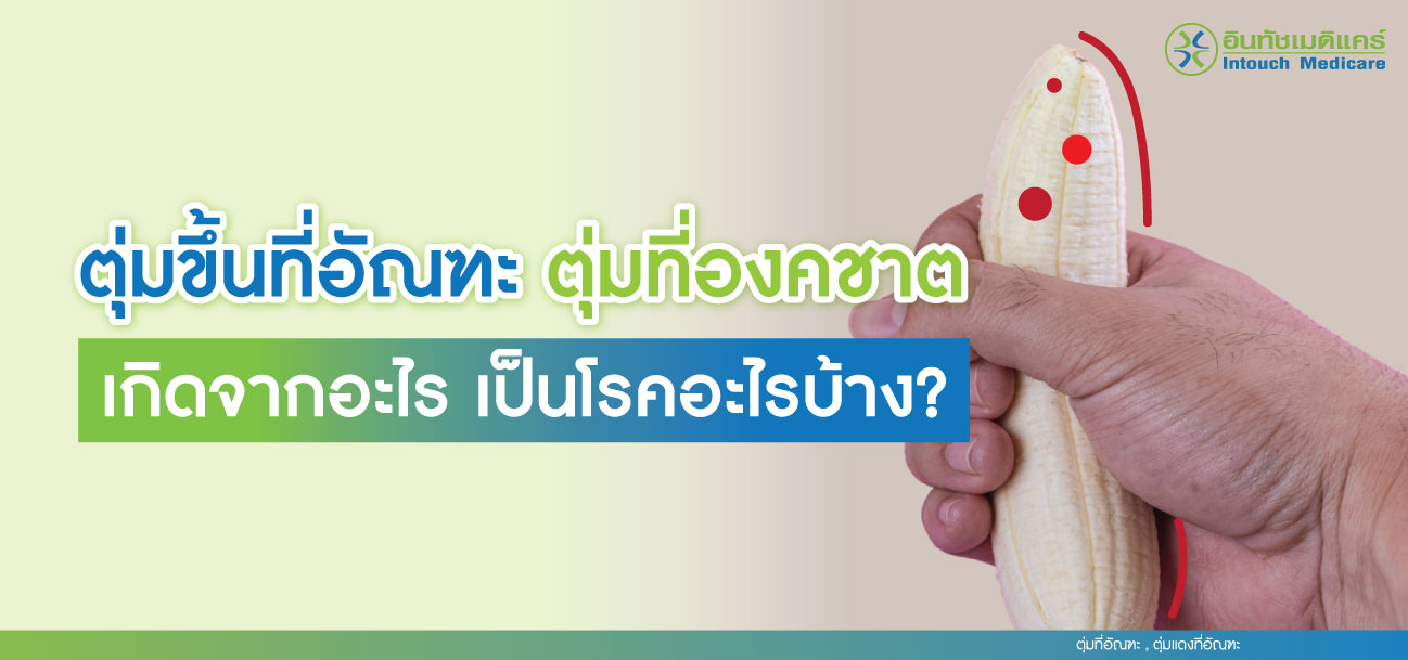 ตุ่มที่อัณฑะ ตุ่มแดงที่อัณฑะ ตุ่มที่อัณฑะ ตุ่มแดงที่อัณฑะ