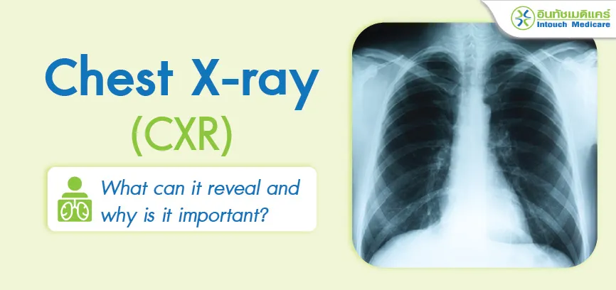 Chest X-ray: What can a chest X-ray reveal?