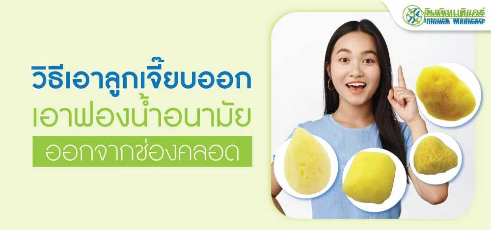 เอาลูกเจี๊ยบออก เอาฟองน้ำอนามัยออกจากช่องคลอด เอาลูกเจี๊ยบออก เอาฟองน้ำอนามัยออกจากช่องคลอดเอาลูกเจี๊ยบออก เอาฟองน้ำอนามัยออกจากช่องคลอด