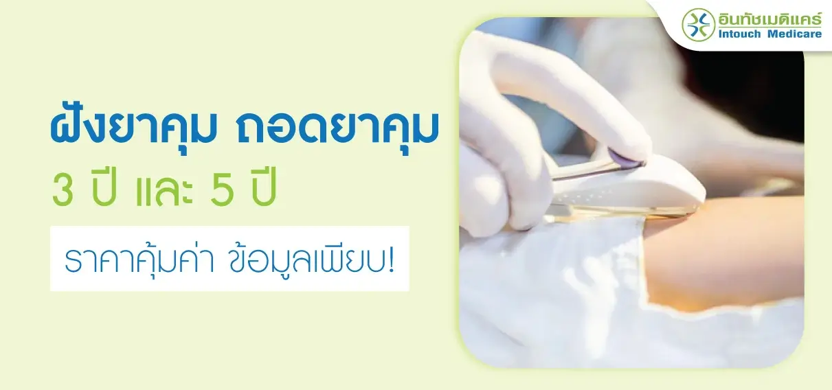 ฝังยาคุมและถอดยาคุมกำเนิด (ถอดเข็มยาคุม) ฝังยาคุมและถอดยาคุมกำเนิด (ถอดเข็มยาคุม)