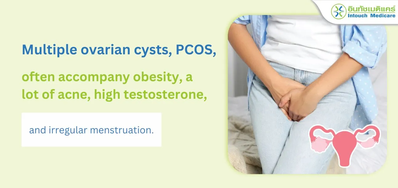 Multiple ovarian cysts, PCOS, often accompany obesity, a lot of acne, high testosterone, and irregular menstruation. Multiple ovarian cysts, PCOS, often accompany obesity, a lot of acne, high testosterone, and irregular menstruation.
