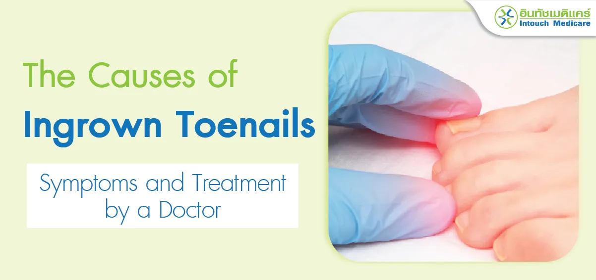The Causes of Ingrown Toenails. Symptoms and Treatment by a Doctor The Causes of Ingrown Toenails. Symptoms and Treatment by a Doctor