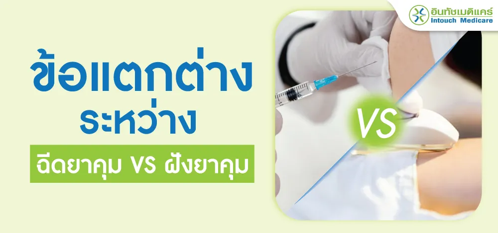 ฝังยาคุมกับฉีดยาคุมอันไหนดีกว่า ฝังยาคุมกับฉีดยาคุมอันไหนดีกว่า