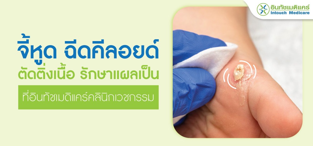 จี้หูด ฉีดคีลอยด์ ตัดติ่งเนื้อ รักษาแผลเป็น จี้หูด ฉีดคีลอยด์ ตัดติ่งเนื้อ รักษาแผลเป็น