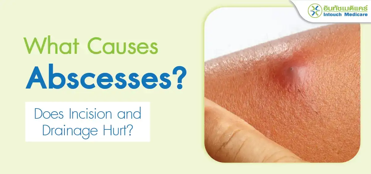 What Causes Abscesses? Does Incision and Drainage Hurt?