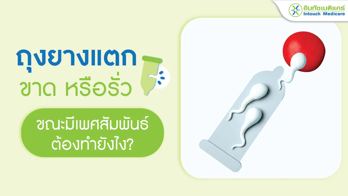 ถุงยางแตก ขาด หรือรั่ว ขณะมีเพศสัมพันธ์ ต้องทำยังไง