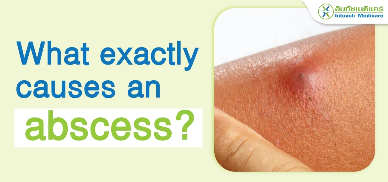 What exactly causes an abscess? Is it painful to cut into an abscess and drain the pus?