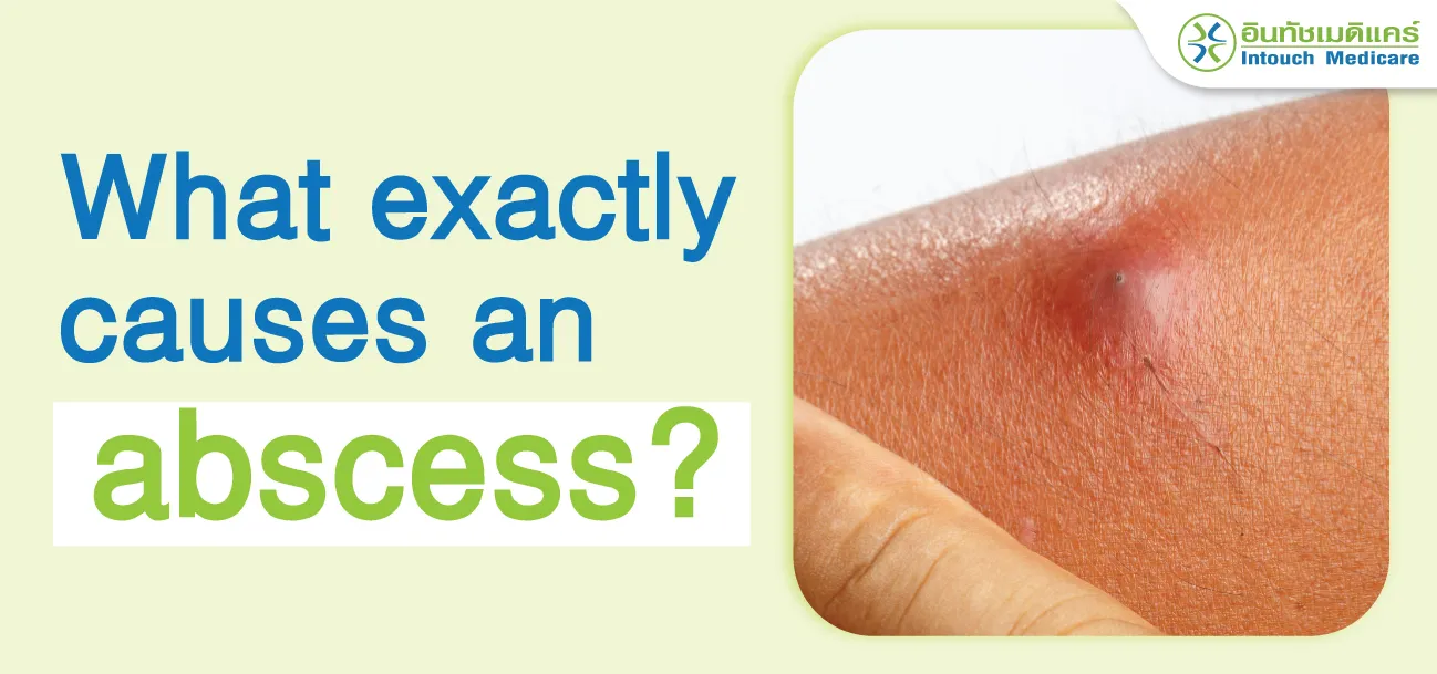 What causes an abscess? Does it hurt to drain pus? - intouchmedicare
