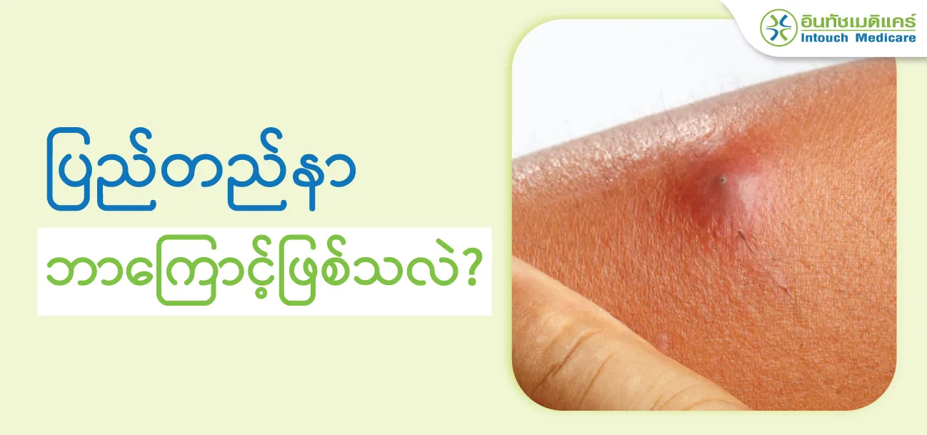 ပြည်တည်နာ ဘာကြောင့်ဖြစ်သလဲ?ပြည်တည်နာပြည်ဖောက်ထုတ်ရင်နာပါသလား? ပြည်တည်နာ ဘာကြောင့်ဖြစ်သလဲ?ပြည်တည်နာပြည်ဖောက်ထုတ်ရင်နာပါသလား?