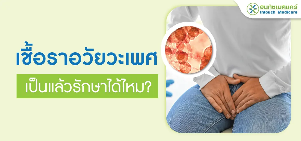 เชื้อราอวัยวะเพศชาย เชื้อราอวัยวะเพศชาย