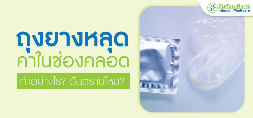 ถุงยางหลุดคาในช่องคลอด ทำอย่างไร?