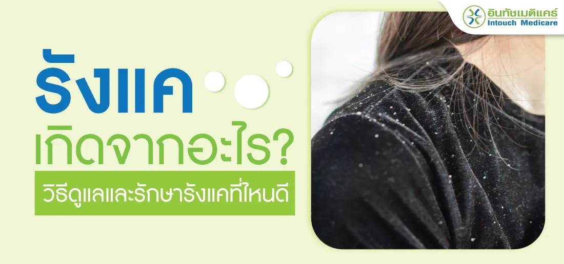 รังแค เกิดจากอะไร รังแค เกิดจากอะไร