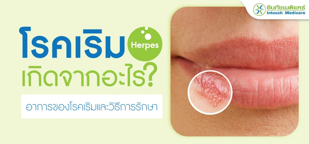โรคเริม เกิดจากอะไร โรคเริม เกิดจากอะไร