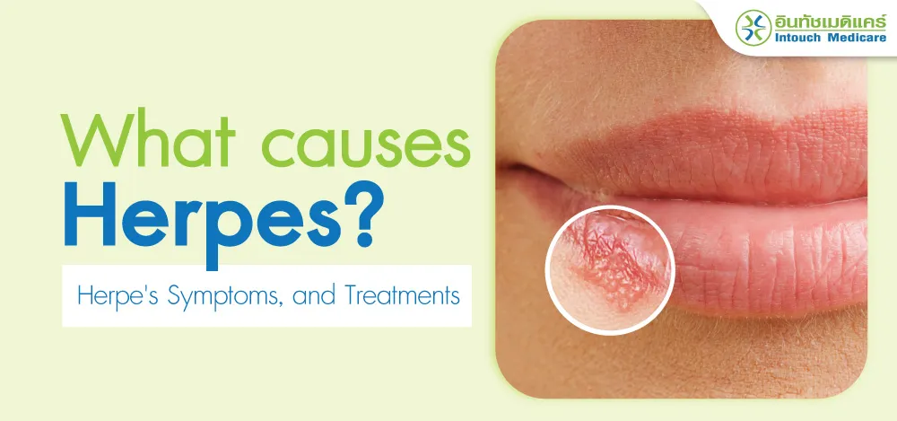 What causes herpes