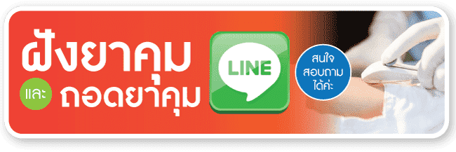 ฝังยาคุมและถอดยาคุม line สอบถาม