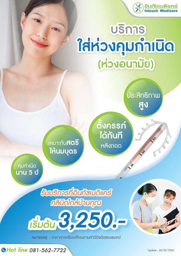 ราคาใส่ห่วงยาคุมกำเนิด 