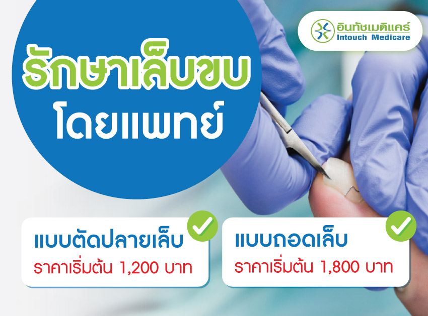 ราคารักษาเล็บขบ ราคารักษาเล็บขบ