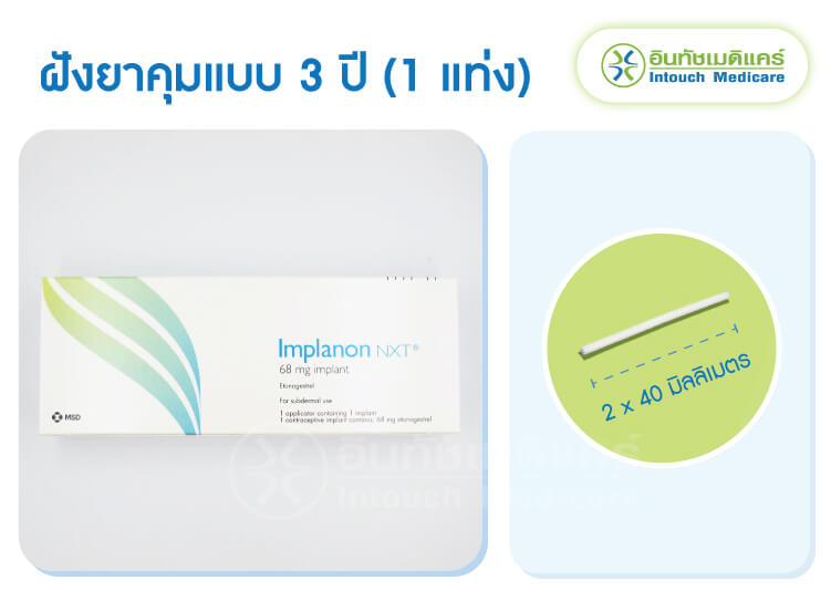 ฝังยาคุมกำเนิด 3 ปี ยี่ห้อ Implanon (อิมพลานอน) ฝังยาคุมกำเนิด 3 ปี ยี่ห้อ Implanon (อิมพลานอน)