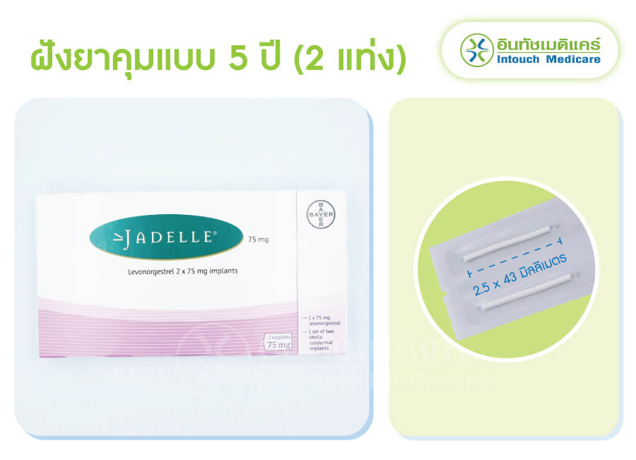 ฝังยาคุมกำเนิด 5 ปี ยี่ห้อ Jadelle (จาเดลล์) ฝังยาคุมกำเนิด 5 ปี ยี่ห้อ Jadelle (จาเดลล์)
