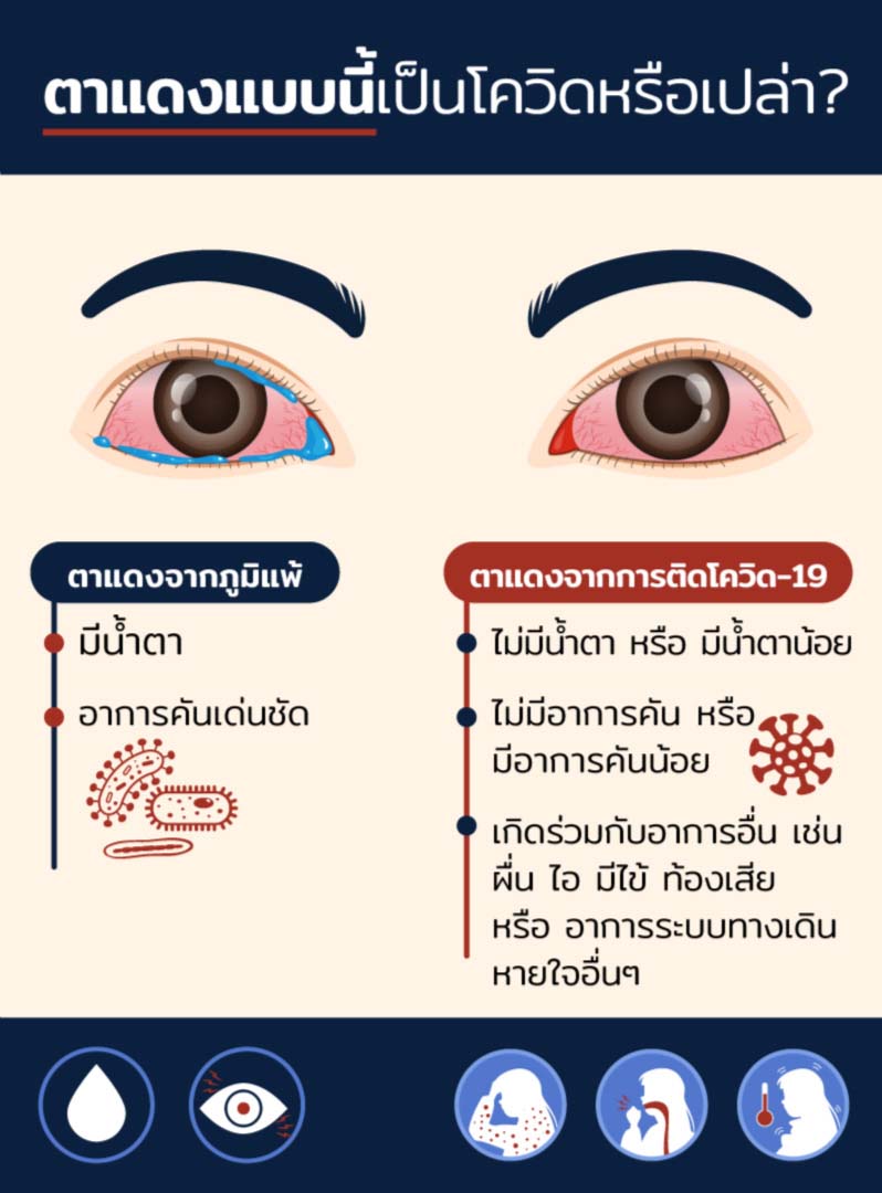 อาการตาแดงทั่วๆไป กับอาการตาแดงจากโควิด