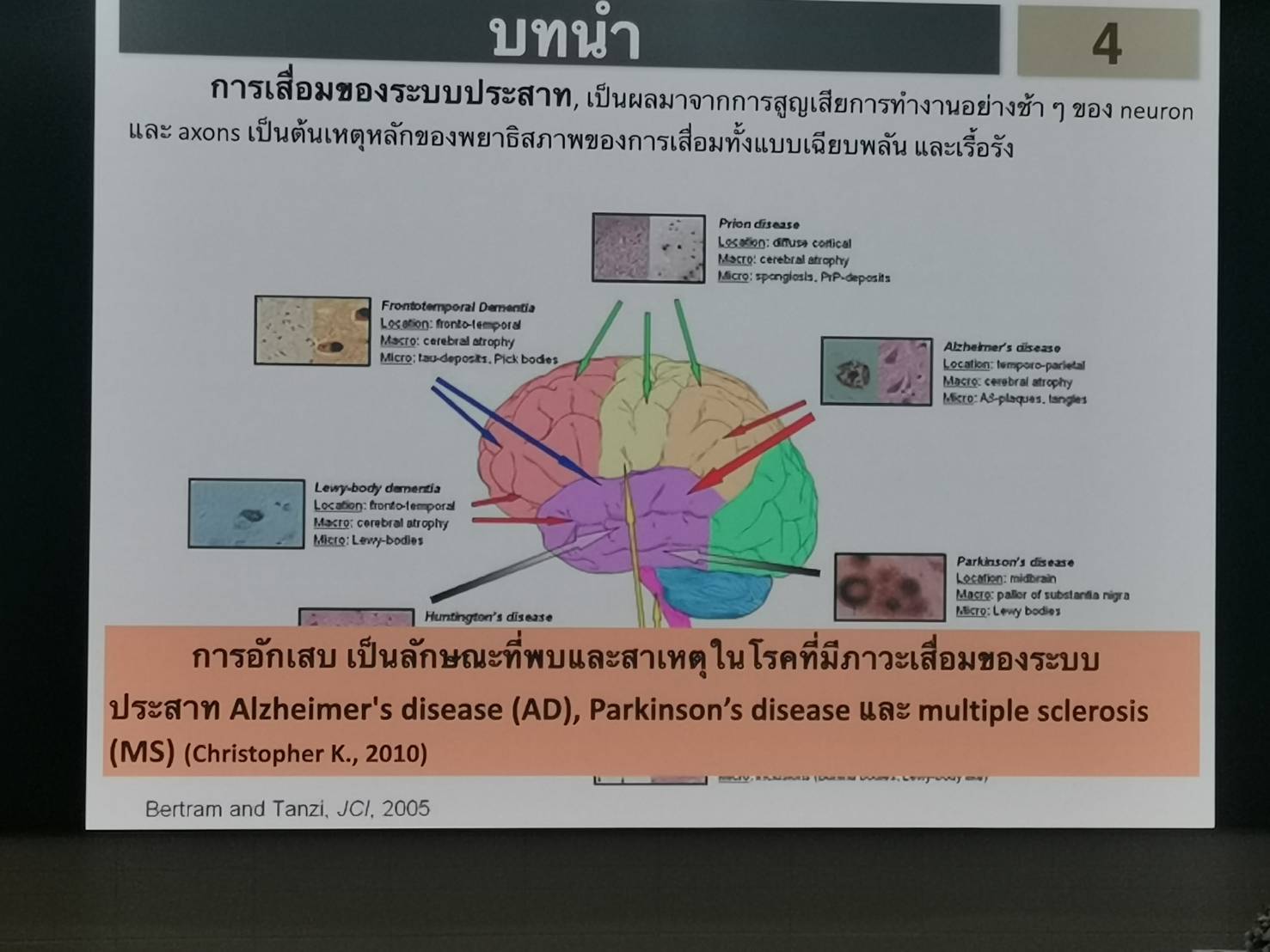 ความเสื่อมของระบบประสาท เกิดจากการอักเสบ