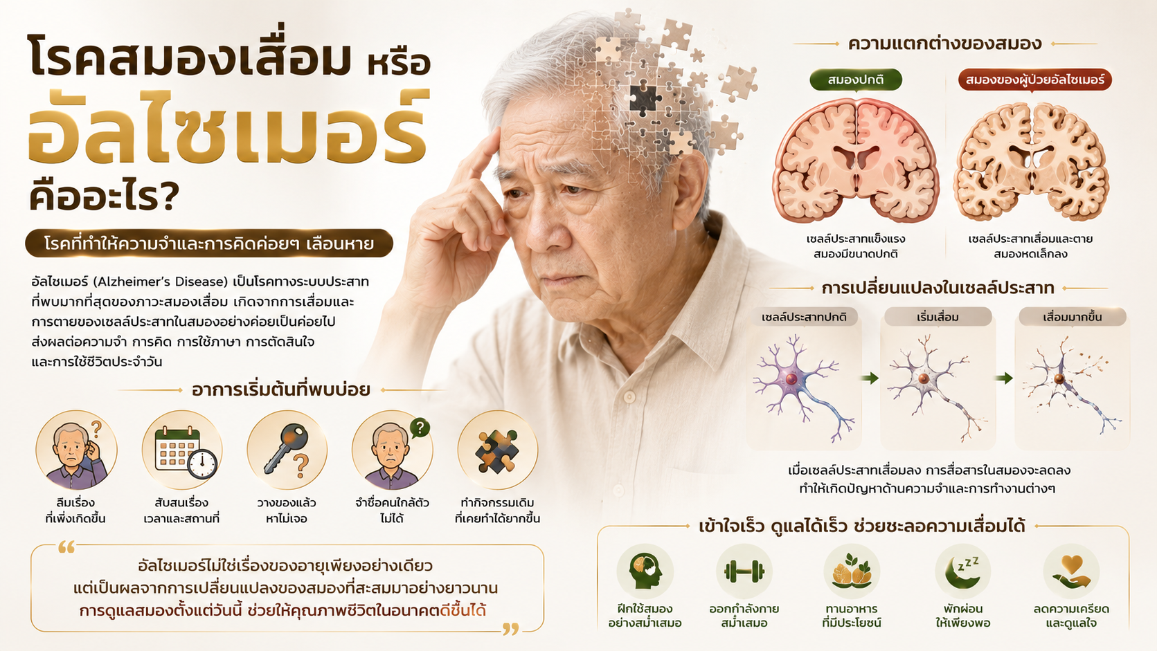 โรคสมองเสื่อม หรือ โรคอัลไซเมอร์