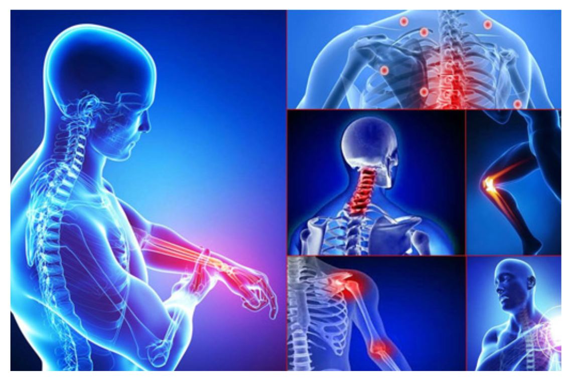 Đau cơ xương khớp