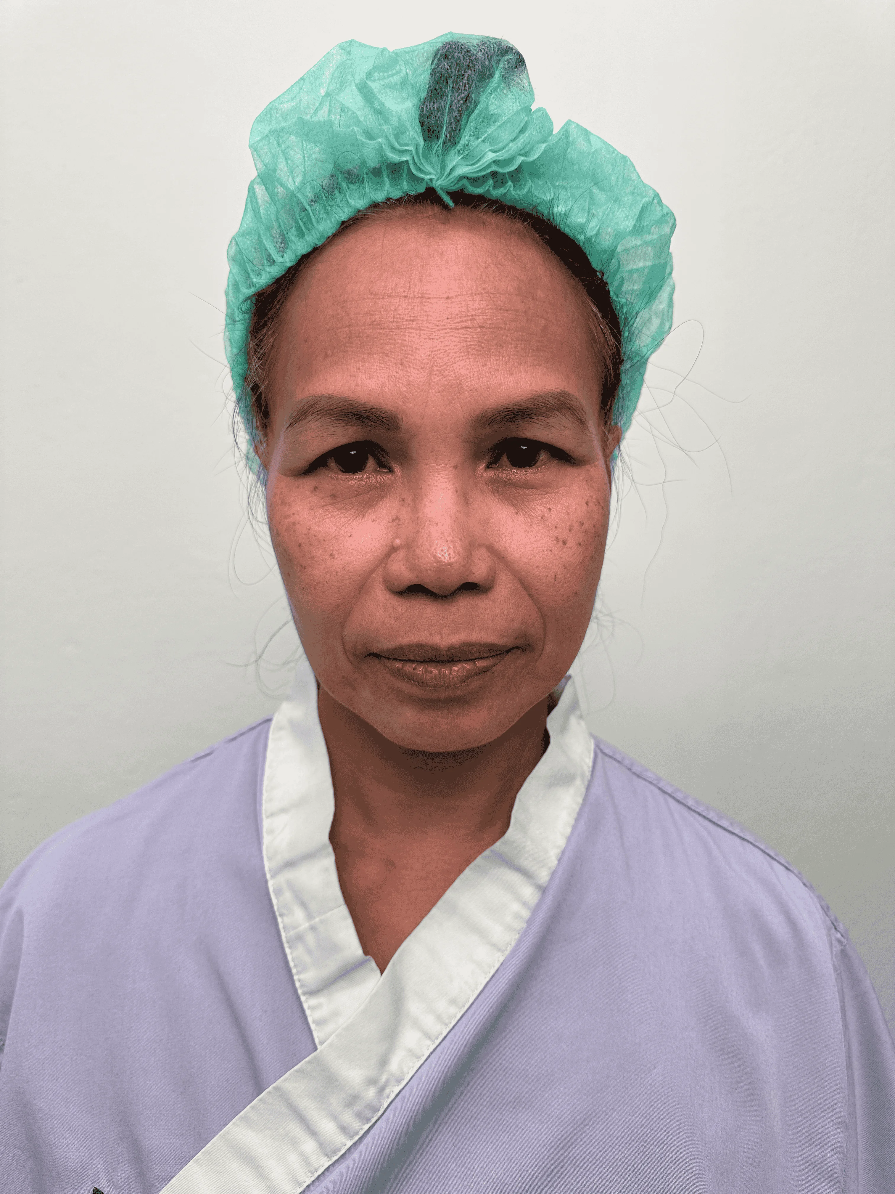 เคสดึงหน้าผาก 