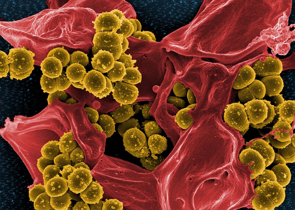 Signs of stigma and poor mental health among carriers of MRSA