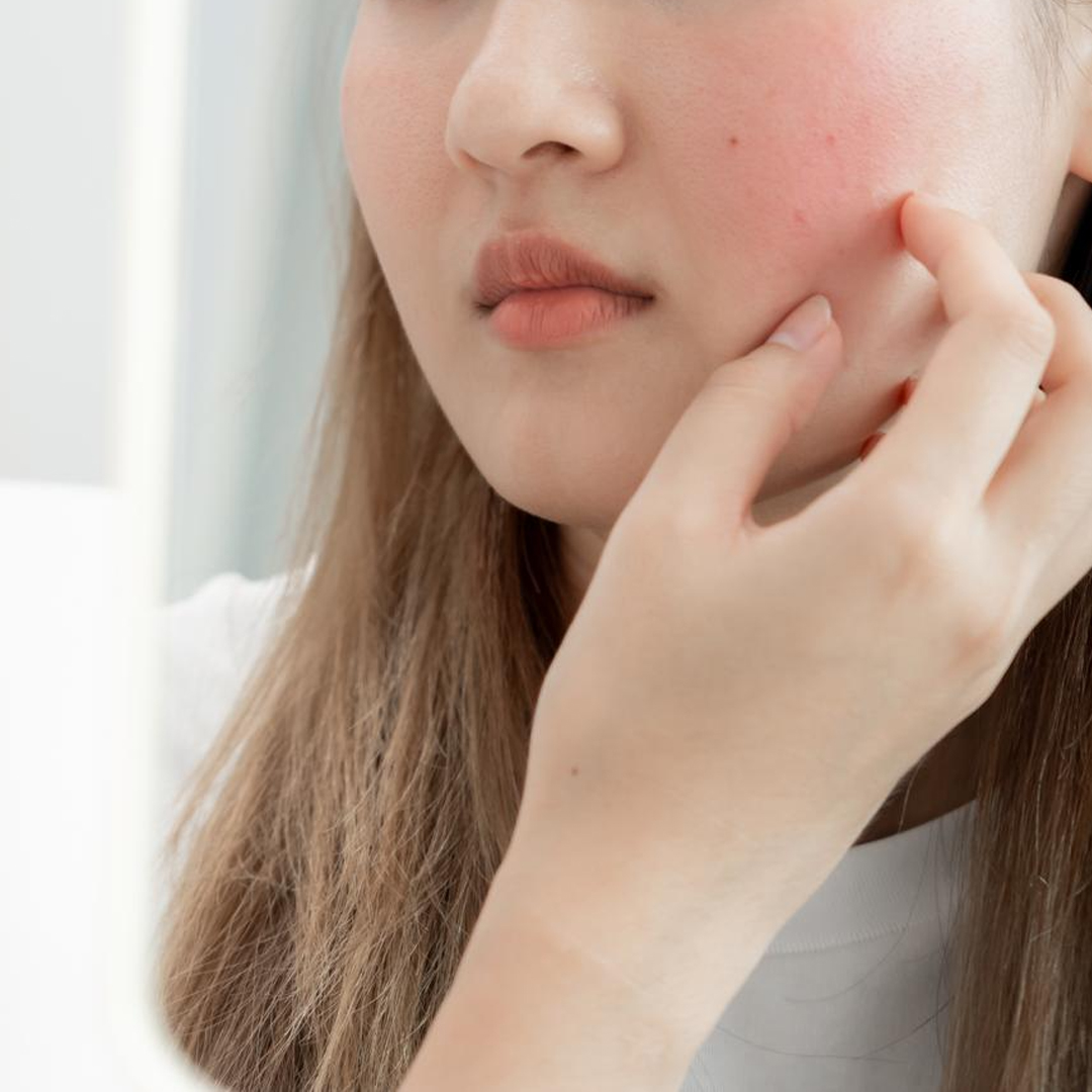 อาหารเสริม