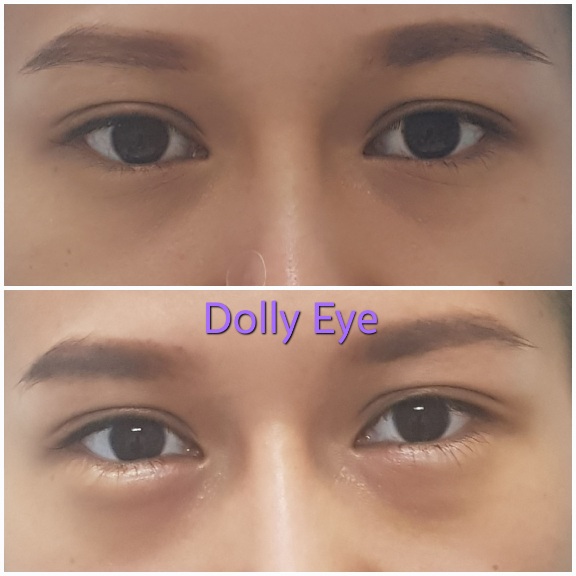 dollyeye